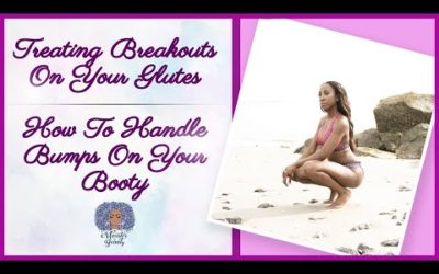 Treating Breakouts On Your Glutes | How To Handle Bumps On Your Booty